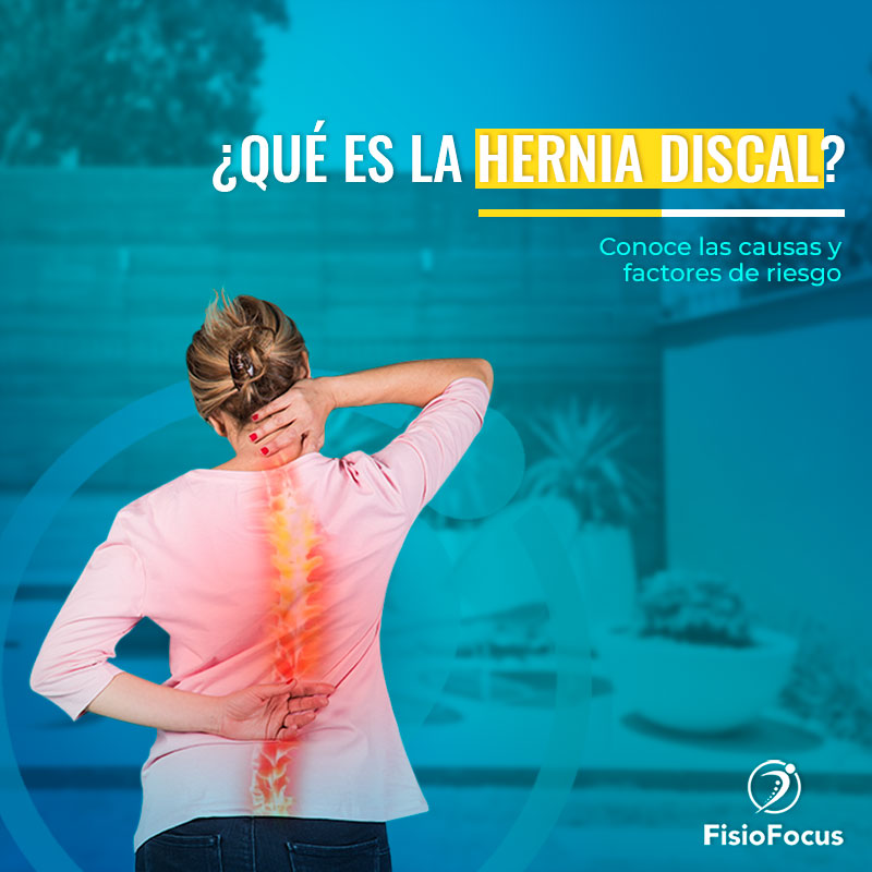 Hernia Discal Conoce los síntomas y cómo prevenirla FisioFocus