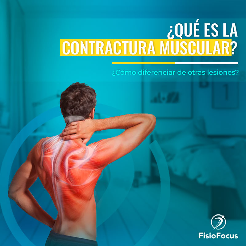 contracturamuscular-fisiofocus