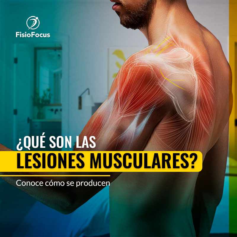 post01_lesionesmusculares_fisiofocus